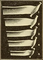 Picture 202 of 481 from Fractures and dislocations, diagnosis and treatment (1915), leaf 297