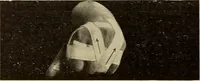 Picture 232 of 481 from Fractures and dislocations, diagnosis and treatment (1915), leaf 335