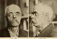 An illustration from Fractures and dislocations, diagnosis and treatment (1915)