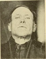 An illustration from Fractures and dislocations, diagnosis and treatment (1915)
