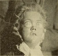 Picture 250 of 481 from Fractures and dislocations, diagnosis and treatment (1915), leaf 359