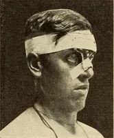 An illustration from Fractures and dislocations, diagnosis and treatment (1915)