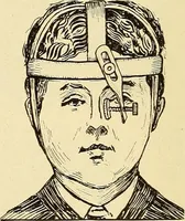 An illustration from Fractures and dislocations, diagnosis and treatment (1915)