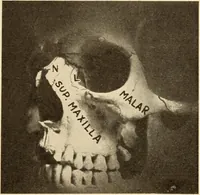 Picture 255 of 481 from Fractures and dislocations, diagnosis and treatment (1915), leaf 366