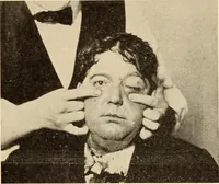 An illustration from Fractures and dislocations, diagnosis and treatment (1915)