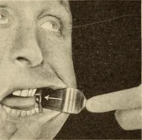 Picture 265 of 481 from Fractures and dislocations, diagnosis and treatment (1915), leaf 386