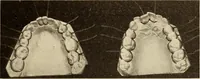 Picture 276 of 481 from Fractures and dislocations, diagnosis and treatment (1915), leaf 400