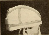 Picture 282 of 481 from Fractures and dislocations, diagnosis and treatment (1915), leaf 418