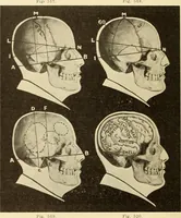 An illustration from Fractures and dislocations, diagnosis and treatment (1915)