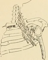 An illustration from Fractures and dislocations, diagnosis and treatment (1915)