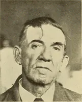 An illustration from Fractures and dislocations, diagnosis and treatment (1915)