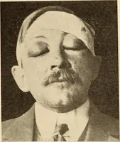 Picture 293 of 481 from Fractures and dislocations, diagnosis and treatment (1915), leaf 450