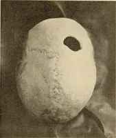 An illustration from Fractures and dislocations, diagnosis and treatment (1915)