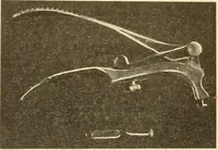 Picture 296 of 481 from Fractures and dislocations, diagnosis and treatment (1915), leaf 479