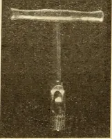 An illustration from Fractures and dislocations, diagnosis and treatment (1915)