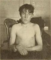 Picture 6 of 481 from Fractures and dislocations, diagnosis and treatment (1915), leaf 48