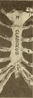 Picture 298 of 481 from Fractures and dislocations, diagnosis and treatment (1915), leaf 484