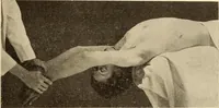 Picture 299 of 481 from Fractures and dislocations, diagnosis and treatment (1915), leaf 488