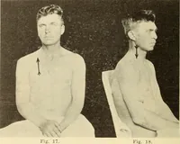 Picture 7 of 481 from Fractures and dislocations, diagnosis and treatment (1915), leaf 49