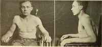 Picture 8 of 481 from Fractures and dislocations, diagnosis and treatment (1915), leaf 49