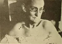 Picture 12 of 481 from Fractures and dislocations, diagnosis and treatment (1915), leaf 51