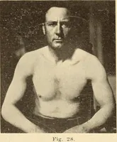 Picture 14 of 481 from Fractures and dislocations, diagnosis and treatment (1915), leaf 52