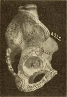 An illustration from Fractures and dislocations, diagnosis and treatment (1915)