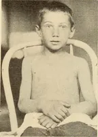 Picture 15 of 481 from Fractures and dislocations, diagnosis and treatment (1915), leaf 54