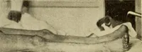 An illustration from Fractures and dislocations, diagnosis and treatment (1915)