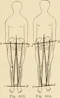 An illustration from Fractures and dislocations, diagnosis and treatment (1915)