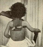 Picture 23 of 481 from Fractures and dislocations, diagnosis and treatment (1915), leaf 58