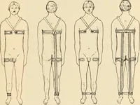 An illustration from Fractures and dislocations, diagnosis and treatment (1915)
