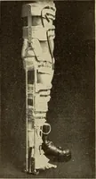 An illustration from Fractures and dislocations, diagnosis and treatment (1915)