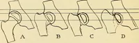 An illustration from Fractures and dislocations, diagnosis and treatment (1915)