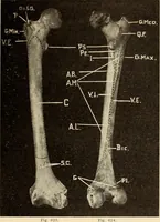 An illustration from Fractures and dislocations, diagnosis and treatment (1915)