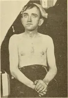 Picture 25 of 481 from Fractures and dislocations, diagnosis and treatment (1915), leaf 63