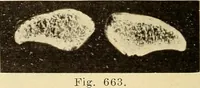 Picture 371 of 481 from Fractures and dislocations, diagnosis and treatment (1915), leaf 631
