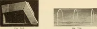 Picture 389 of 481 from Fractures and dislocations, diagnosis and treatment (1915), leaf 676
