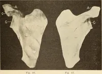 An illustration from Fractures and dislocations, diagnosis and treatment (1915)