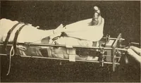 An illustration from Fractures and dislocations, diagnosis and treatment (1915)