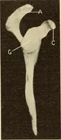 Picture 29 of 481 from Fractures and dislocations, diagnosis and treatment (1915), leaf 69