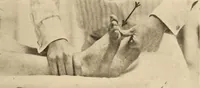 An illustration from Fractures and dislocations, diagnosis and treatment (1915)