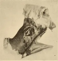 An illustration from Fractures and dislocations, diagnosis and treatment (1915)