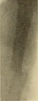 An illustration from Fractures and dislocations, diagnosis and treatment (1915)