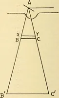 An illustration from Fractures and dislocations, diagnosis and treatment (1915)