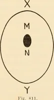 An illustration from Fractures and dislocations, diagnosis and treatment (1915)