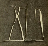 An illustration from Fractures and dislocations, diagnosis and treatment (1915)