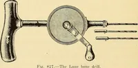 An illustration from Fractures and dislocations, diagnosis and treatment (1915)