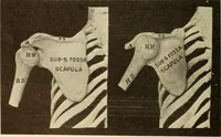 Picture 36 of 481 from Fractures and dislocations, diagnosis and treatment (1915), leaf 79