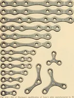 An illustration from Fractures and dislocations, diagnosis and treatment (1915)
